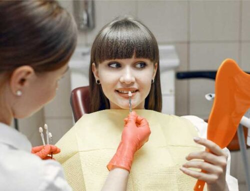 Odontología Estética: Tipos de Carillas dentales