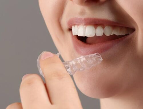 Férulas de Descarga: Protección dental y Tratamiento para el Bruxismo