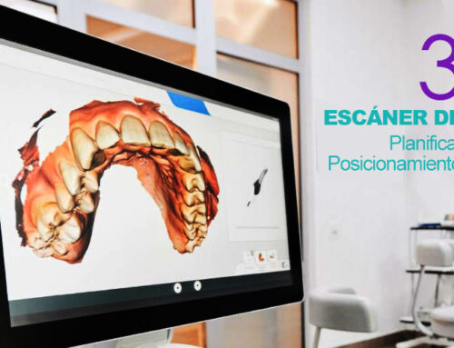 Escáner Dental 3D, esencial para obtener un diagnóstico preciso