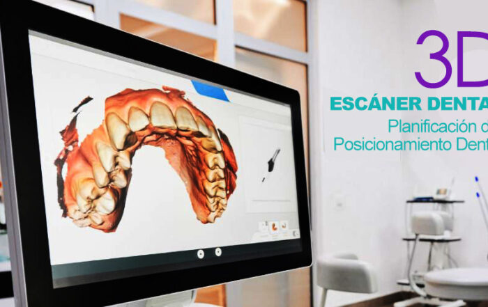 Escáner dental 3D