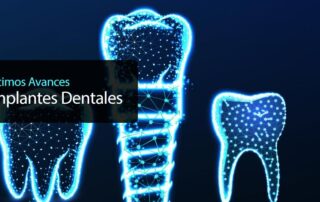 últimos avances en implantes dentales