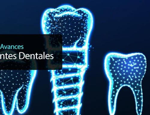 Últimos avances en implantes dentales y su integración ósea