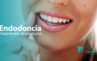 Endodoncia tratamientos de conductos