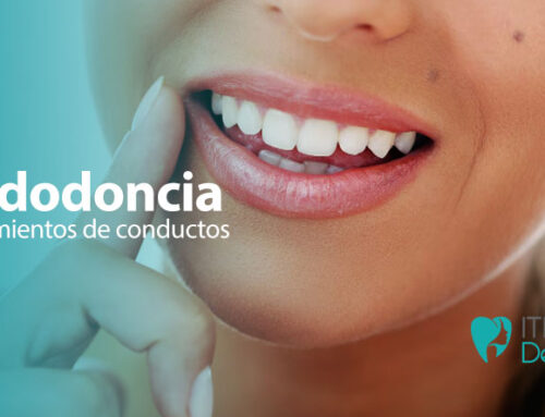 Endodoncia: Tratamientos de Conductos