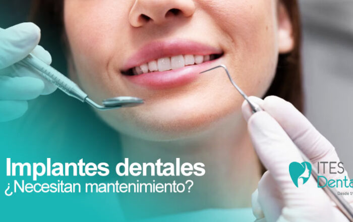 Mantenimiento implantes dentales