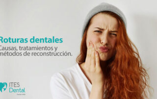 Roturas dentales
