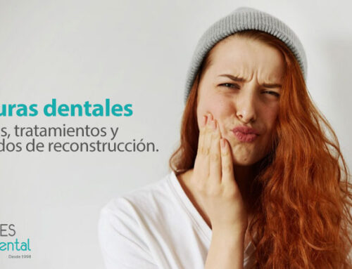 Roturas dentales: causas, tratamientos y métodos de reconstrucción