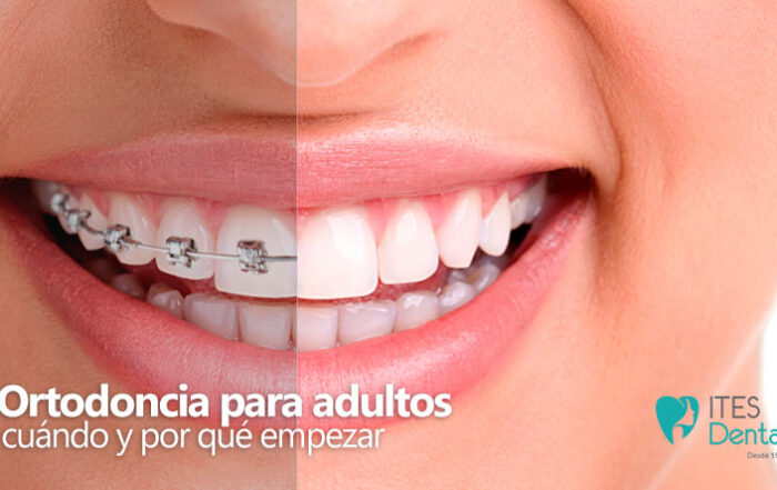 Ortodoncia adultos