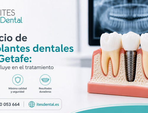 Precio de implantes dentales en Getafe: qué influye en el tratamiento