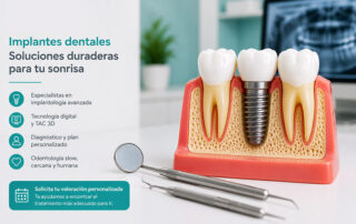 Como saber si necesitas un implante dental
