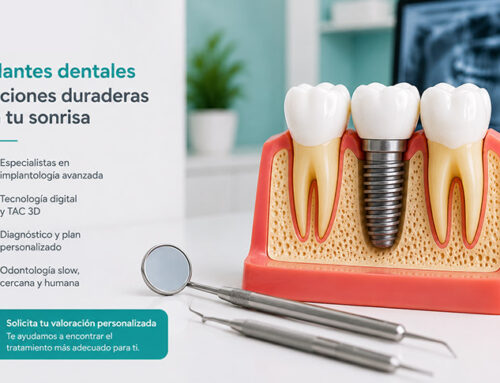 Cómo saber si necesitas un implante dental