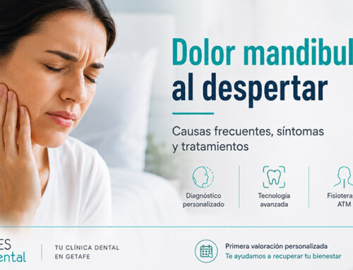Dolor mandibular al despertar: causas frecuentes y cuándo acudir al dentista