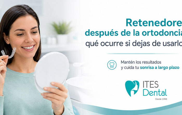 Retenedores después de la ortodoncia